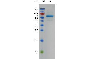 SDS-PAGE (SDS) image for SARS-CoV-2 Spike (BA.2 - Omicron), (RBD) protein (Fc Tag) (ABIN7491018)