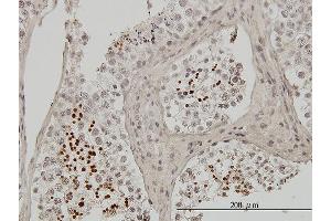 Immunoperoxidase of monoclonal antibody to TNP1 on formalin-fixed paraffin-embedded human testis. (TNP1 antibody  (AA 1-55))