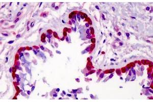Human Lung: Formalin-Fixed, Paraffin-Embedded (FFPE) (METTL7A antibody  (Internal Region))