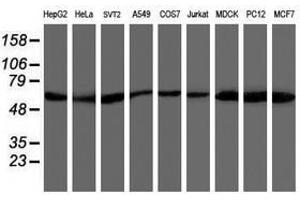 Image no. 7 for anti-V-Akt Murine Thymoma Viral Oncogene Homolog 1 (AKT1) antibody (ABIN1496556) (AKT1 antibody)