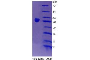 SDS-PAGE (SDS) image for Chimerin (Chimaerin) 2 (CHN2) (AA 101-323) protein (His tag) (ABIN6239086) (CHN2 Protein (AA 101-323) (His tag))