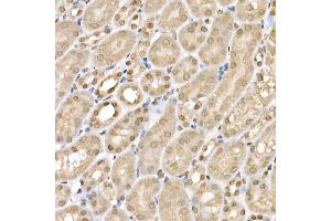 Immunohistochemistry of paraffin-embedded mouse kidney using SLC14 Rabbit pAb (5991) at dilution of 1:200 (40x lens). (SLC14A1 antibody  (C-Term))