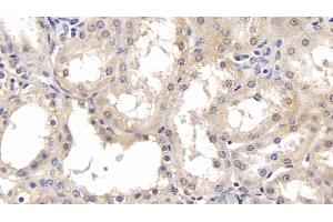 Detection of PARK7 in Human Kidney Tissue using Monoclonal Antibody to Parkinson Disease Protein 7 (PARK7) (PARK7/DJ1 antibody  (AA 2-189))