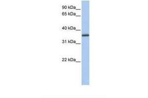 Image no. 1 for anti-UDP-Galactose-4-Epimerase (GALE) (N-Term) antibody (ABIN6738942) (GALE antibody  (N-Term))