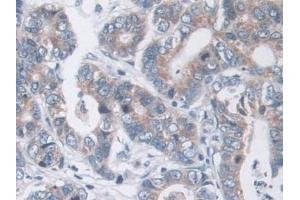 Immunohistochemistry (IHC) image for anti-MOCO Sulphurase C-terminal Domain Containing 1 (MOSC1) (AA 41-335) antibody (ABIN7430258)