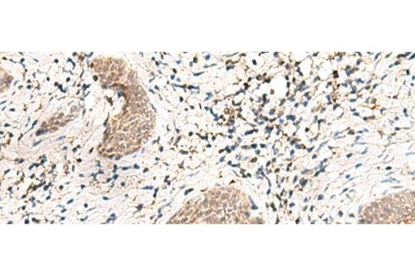 SNRPG antibody