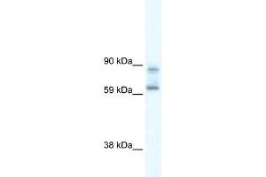 DDX42 antibody used at 5 ug/ml to detect target protein.