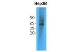 Western Blotting (WB) image for anti-Thiopurine S-Methyltransferase (TPMT) antibody (ABIN781550) (TPMT antibody)