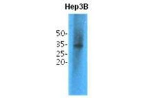 Western Blotting (WB) image for anti-Thiopurine S-Methyltransferase (TPMT) antibody (ABIN781549) (TPMT antibody)