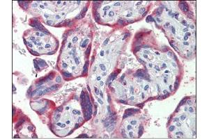 Placenta, Human: Formalin-Fixed, Paraffin-Embedded (FFPE) (PDGFB antibody  (C-Term))
