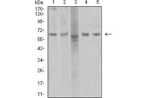Western blot analysis using AP2M1 mouse mAb against COS7 (1), SK-Br-3 (2), MCF-7 (3), T47D (4), and HEK293 (5) cell lysate.