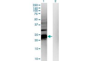 Western Blot analysis of HDHD1A expression in transfected 293T cell line by HDHD1A monoclonal antibody (M05), clone 4F12.