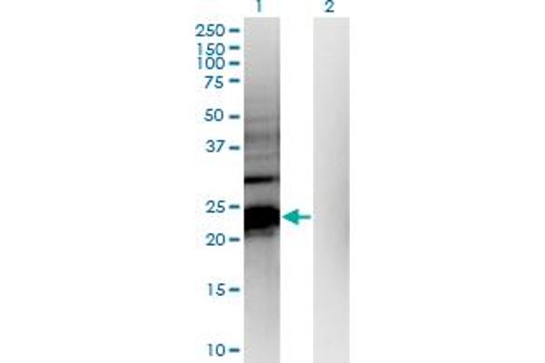 HDHD1 Antikörper  (AA 107-212)