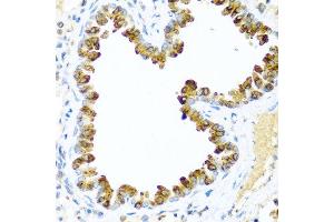 Immunohistochemistry of paraffin-embedded mouse lung using NRG4 antibody at dilution of 1:100 (40x lens). (Neuregulin 4 antibody)