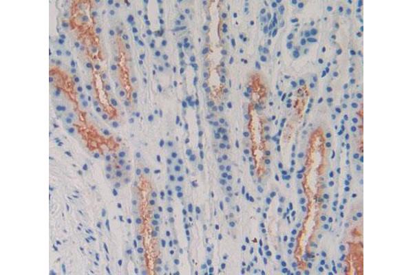 LPHN2 antibody  (AA 139-398)