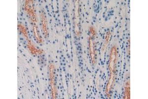 Used in DAB staining on fromalin fixed paraffin- embedded Kidney tissue (LPHN2 antibody  (AA 139-398))