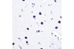 Immunohistochemistry of paraffin-embedded human brain using hnRNP C Rabbit pAb (ABIN7267630) at dilution of 1:100 (40x lens). (HNRNPC antibody)