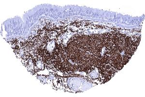 Bronchus mucosa High content of elastin fibres along the bronchus mucosa (Recombinant Elastin antibody)