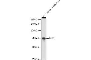 Western blot analysis of extracts of Mouse large intestine, using PLK3 antibody (ABIN6130232, ABIN6145779, ABIN6145780 and ABIN6224749) at 1:1000 dilution. (PLK3 antibody  (AA 487-646))