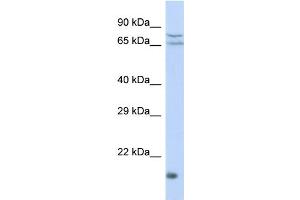 Host: Rabbit Target Name: ZNF195 Sample Type: HepG2 Whole cell lysates Antibody Dilution: 1. (ZNF195 antibody  (N-Term))