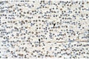 Immunohistochemical staining (Formalin-fixed paraffin-embedded sections) of human brain with GAPVD1 polyclonal antibody  at 4-8 ug/mL working concentration. (GAPVD1 antibody  (N-Term))