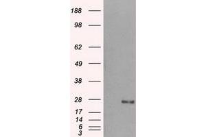 HEK293T cells were transfected with the pCMV6-ENTRY control (Left lane) or pCMV6-ENTRY DCXR (Right lane) cDNA for 48 hrs and lysed. (DCXR antibody)