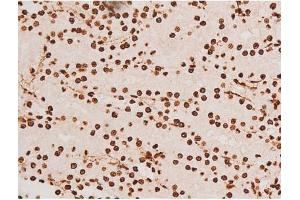 Immunohistochemistry (IHC) image for anti-REL proto-oncogene (c-Rel) (pSer503) antibody (ABIN6255382)