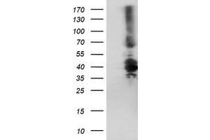 HEK293T cells were transfected with the pCMV6-ENTRY control (Left lane) or pCMV6-ENTRY DTNB (Right lane) cDNA for 48 hrs and lysed. (Dystrobrevin beta antibody)