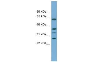 APOL2 antibody used at 0. (Apolipoprotein L 2 antibody  (Middle Region))