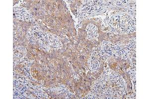 IHC analysis of CDK1 using anti-CDK1 antibody (ABIN7602240). (CDK1 antibody  (AA 66-297))