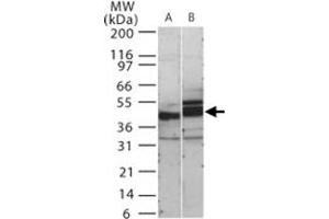 Western blot analysis of human SIGIRR in 15 ugs of (A) human kidney and (B) mouse kidney cell lysate. (SIGIRR antibody  (AA 334-358))