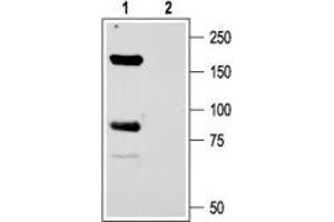 Expression of ASIC1 in rat brain - Immunohistochemical staining of rat globus pallidus using Anti-ASIC1 Antibody (ABIN7042915, ABIN7045236 and ABIN7045237). (ASIC1 antibody  (C-Term, Intracellular))