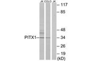 Western blot analysis of extracts from Jurkat/COLO cells, using PITX1 Antibody. (PITX1 antibody  (AA 121-170))
