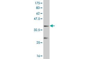 Western Blot detection against Immunogen (37 KDa) . (PDX1 antibody  (AA 109-208))