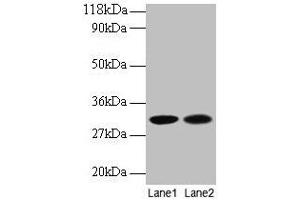 Western blot All lanes: MRPL9 antibody at 2 μg/mL Lane 1: EC109 whole cell lysate Lane 2: 293T whole cell lysate Secondary Goat polyclonal to rabbit IgG at 1/15000 dilution Predicted band size: 31 kDa Observed band size: 31 kDa
