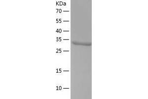 Western Blotting (WB) image for Quinolinate Phosphoribosyltransferase (QPRT) (AA 1-297) protein (His tag) (ABIN7124728) (QPRT Protein (AA 1-297) (His tag))