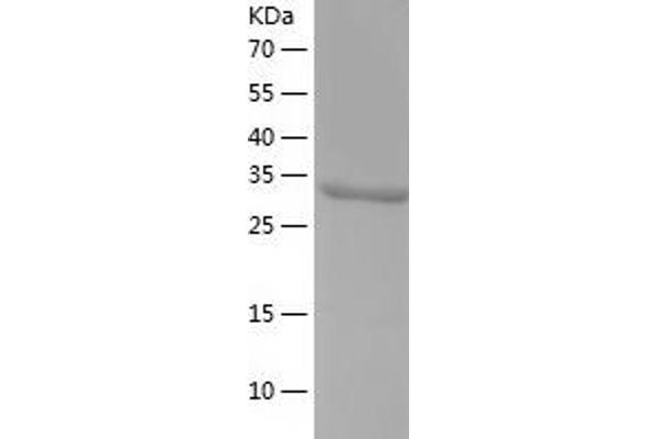 QPRT Protein (AA 1-297) (His tag)