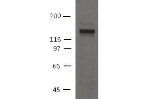Image no. 1 for anti-Desmoglein 2 (DSG2) (AA 37-164) antibody (ABIN1169682) (Desmoglein 2 antibody  (AA 37-164))