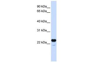 C1QTNF1 antibody used at 1 ug/ml to detect target protein.
