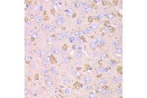 Immunohistochemistry of paraffin-embedded rat brain using TXN2 antibody at dilution of 1:100 (x40 lens). (TXN2 antibody)