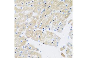 Immunohistochemistry of paraffin-embedded mouse heart using TGM5 antibody at dilution of 1:200 (40x lens). (Transglutaminase 5 antibody)