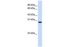C18ORF10 antibody used at 1 ug/ml to detect target protein. (TPGS2 antibody  (Middle Region))