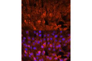 Immunofluorescence analysis of C6 cells using CISH antibody (ABIN7266663) at dilution of 1:100. (CISH antibody  (AA 17-130))