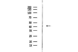 Western blot analysis of lysates from COLO205 cells(LPS, 4h treatment), using ESE1 Antibody at 1/1000 dilution.