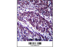 OGDH Antibody immunohistochemistry analysis in formalin fixed and paraffin embedded human heart tissue followed by peroxidase conjugation of the secondary antibody and DAB staining. (alpha KGDHC antibody  (C-Term))
