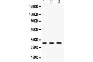 Anti- Peroxiredoxin 4 Picoband antibody, Western blottingAll lanes: Anti Peroxiredoxin 4  at 0. (Peroxiredoxin 4 antibody  (C-Term))