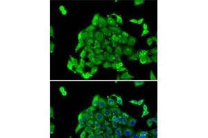 Immunofluorescence analysis of MCF7 cells using RPS14 Polyclonal Antibody