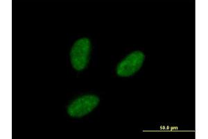 Immunofluorescence of purified MaxPab antibody to IRAK1BP1 on HeLa cell.
