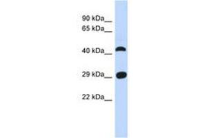 Image no. 1 for anti-Chromosome 4 Open Reading Frame 22 (C4orf22) (AA 35-84) antibody (ABIN6741345) (C4orf22 antibody  (AA 35-84))