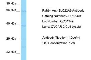 Western Blotting (WB) image for anti-Solute Carrier Family 22 Member 5 (SLC22A5) (C-Term) antibody (ABIN2789486) (SLC22A5 antibody  (C-Term))